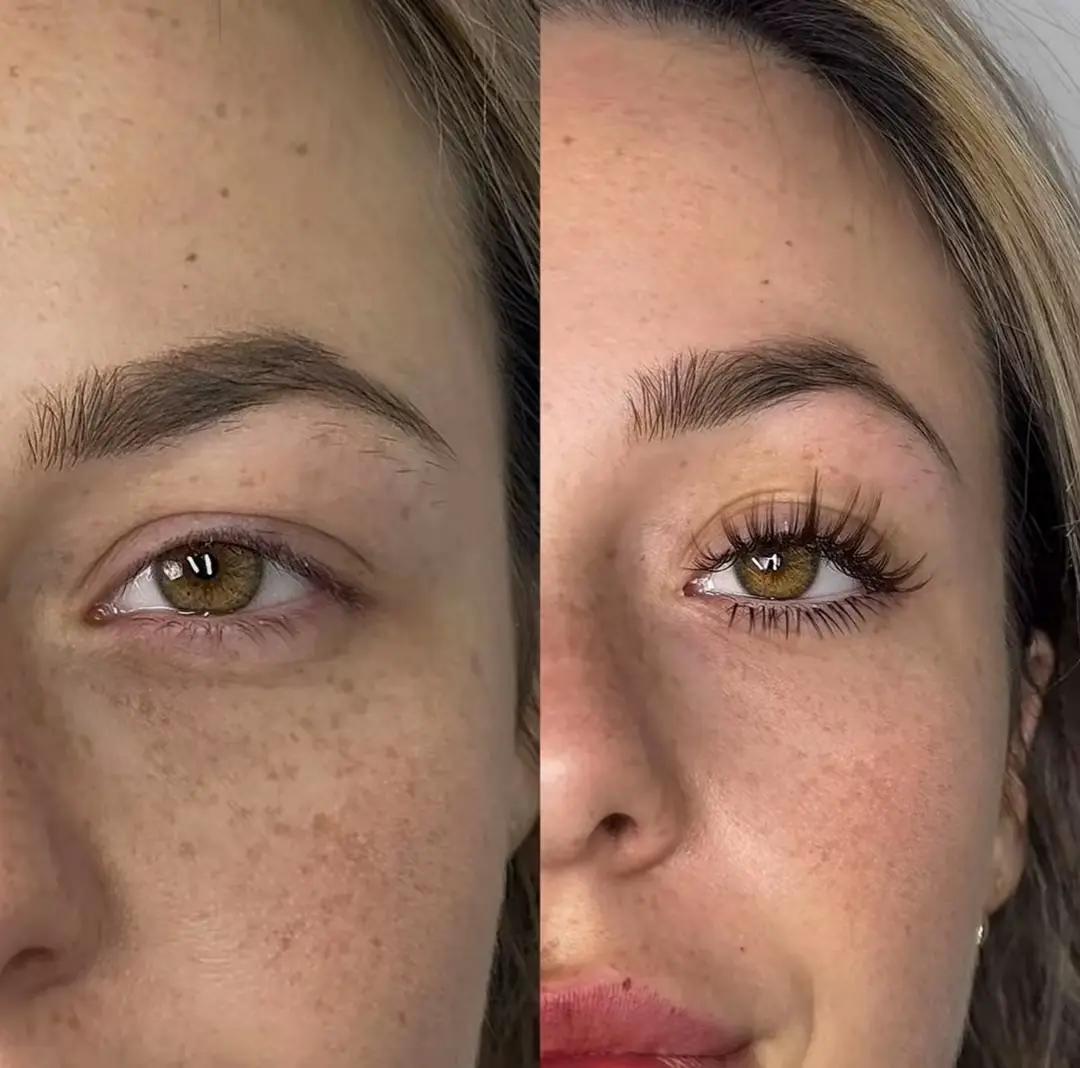 Before & After